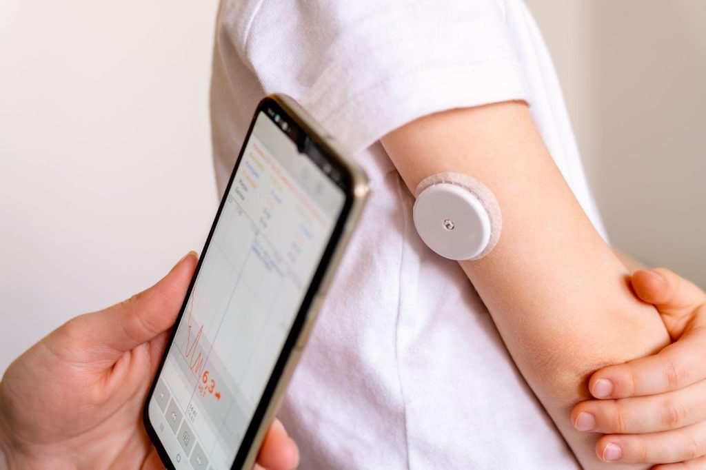 Continuous glucose monitoring (CGM) singapore