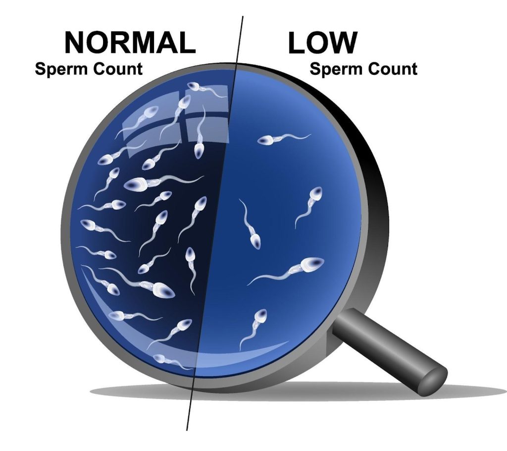 Male Infertility Singapore
